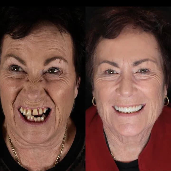 Azure Dental patient — before and after