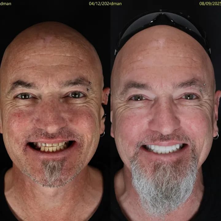 Azure Dental patient — before and after